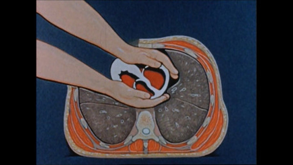 이미지 = Treatment of Cardiac Arrest